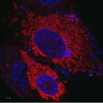  Live COS-7 expressing mitochondrial cytochrome oxidase 8A-SNAP (COX8A-SNAP) were labeled with SNAP-Cell TMR-Star (red). Nuclei were counterstained with Hoechst 33342 (blue).