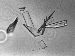 FokI crystals (Ira Schildkraut and Lydia Dorner, New England Biolabs)